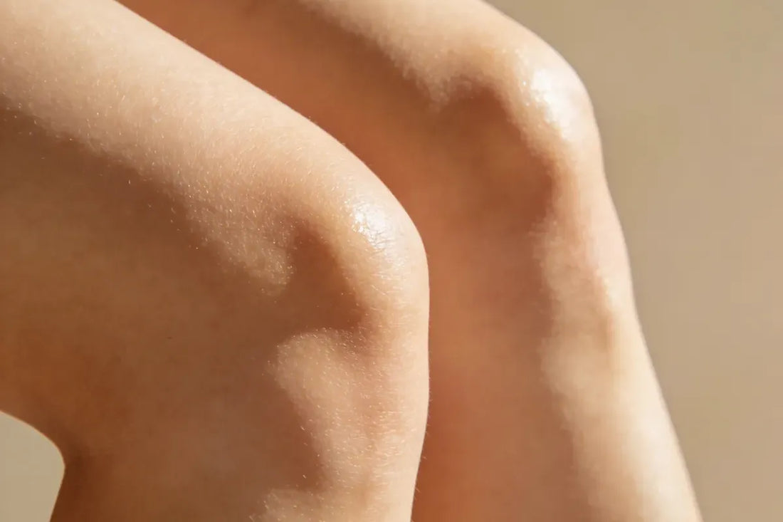 Celulitis, estrías y flacidez: por qué un sérum corporal funciona mejor que una crema común